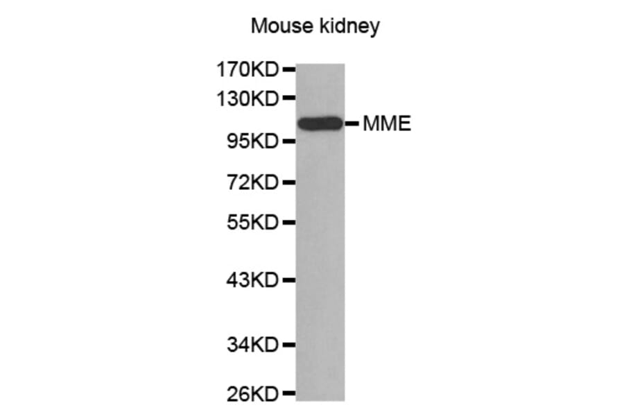 Western Blot - Anti-MME Antibody (A0088) - Antibodies.com