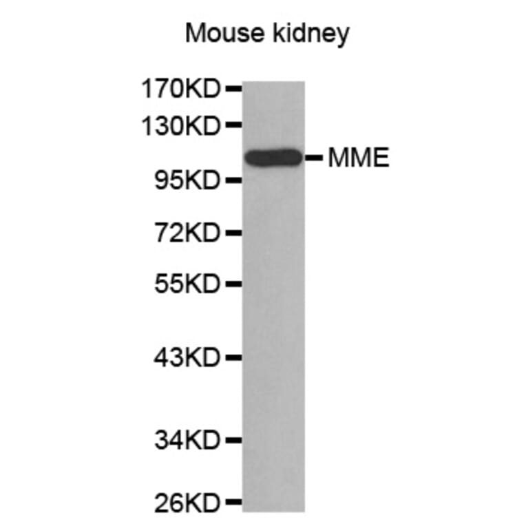 Western Blot - Anti-MME Antibody (A0088) - Antibodies.com