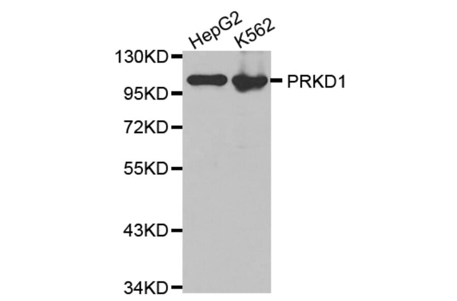 Western Blot - Anti-PRKD1 Antibody (A0101) - Antibodies.com