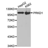 Western Blot - Anti-PRKD1 Antibody (A0101) - Antibodies.com