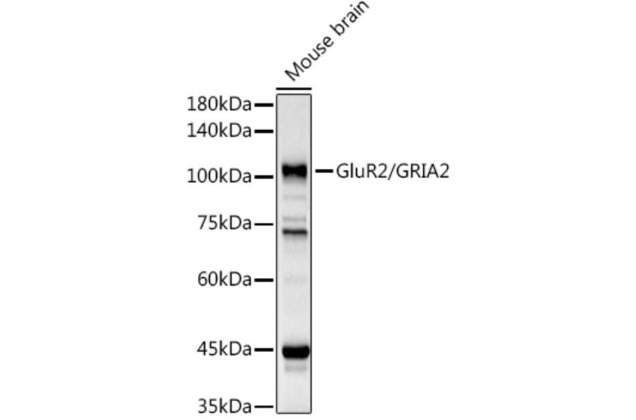 Western Blot - Anti-Ionotropic Glutamate receptor 2 Antibody (A12521) - Antibodies.com