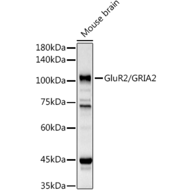 Western Blot - Anti-Ionotropic Glutamate receptor 2 Antibody (A12521) - Antibodies.com