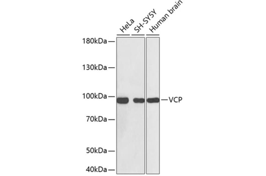 Western Blot - Anti-VCP Antibody (A0125) - Antibodies.com