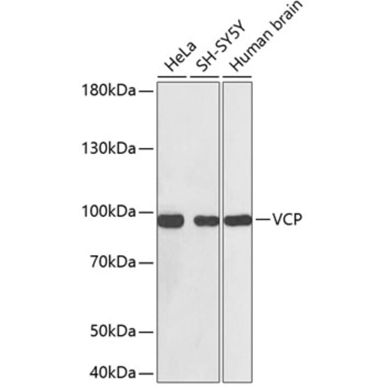 Western Blot - Anti-VCP Antibody (A0125) - Antibodies.com