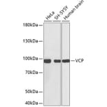 Western Blot - Anti-VCP Antibody (A0125) - Antibodies.com