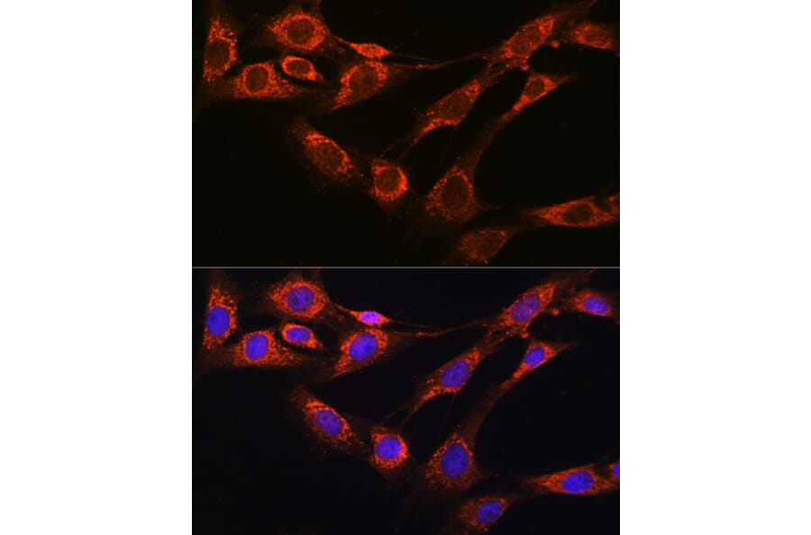 Immunofluorescence - Anti-Nicastrin Antibody (A12524) - Antibodies.com