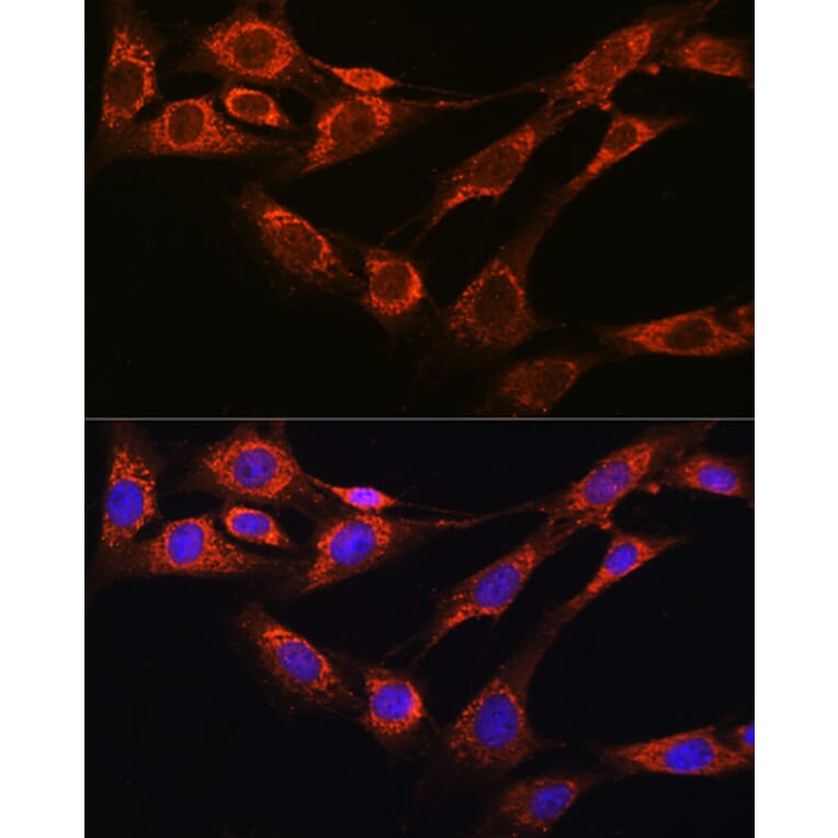 Immunofluorescence - Anti-Nicastrin Antibody (A12524) - Antibodies.com