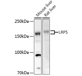 Western Blot - Anti-LRP5 Antibody (A12525) - Antibodies.com
