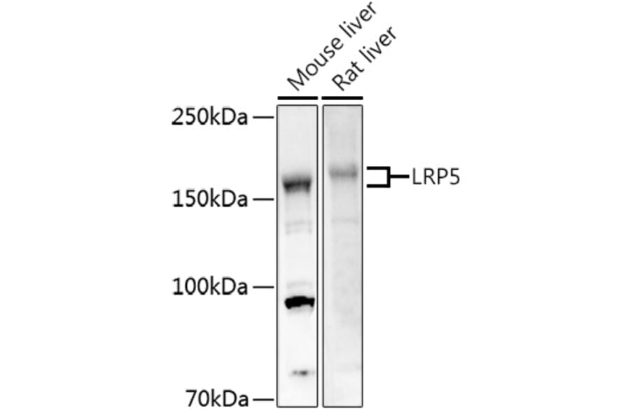 Western Blot - Anti-LRP5 Antibody (A12525) - Antibodies.com