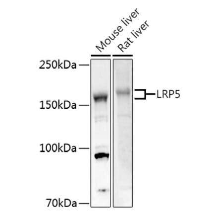 Western Blot - Anti-LRP5 Antibody (A12525) - Antibodies.com