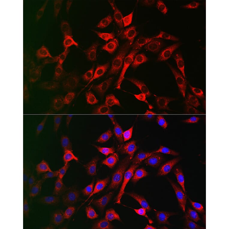 Immunofluorescence - Anti-LRP5 Antibody (A12525) - Antibodies.com