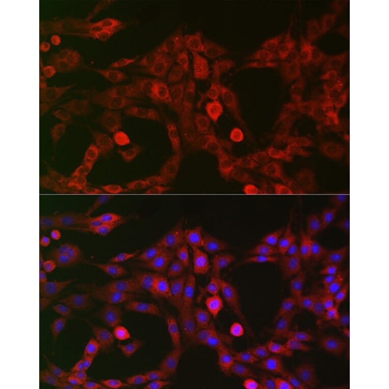 Immunofluorescence - Anti-LRP5 Antibody (A12525) - Antibodies.com