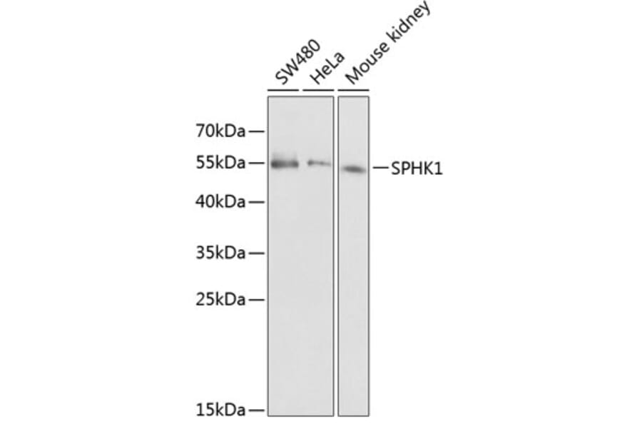 Western Blot - Anti-SPHK1 Antibody (A12526) - Antibodies.com