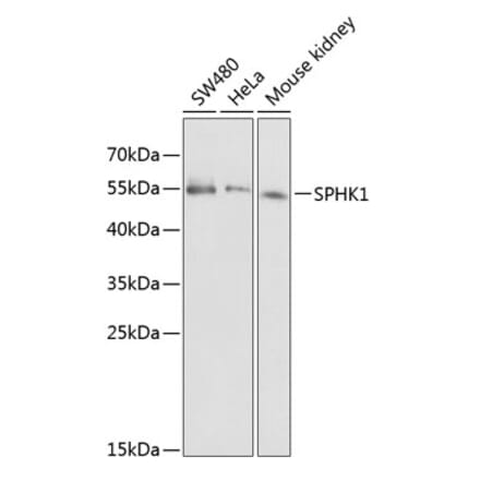 Western Blot - Anti-SPHK1 Antibody (A12526) - Antibodies.com