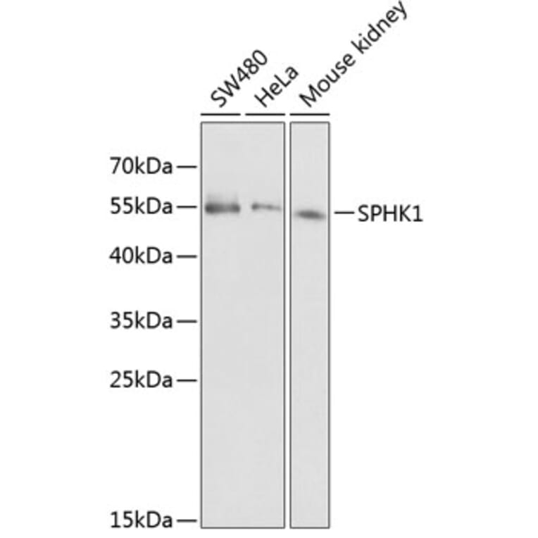 Western Blot - Anti-SPHK1 Antibody (A12526) - Antibodies.com