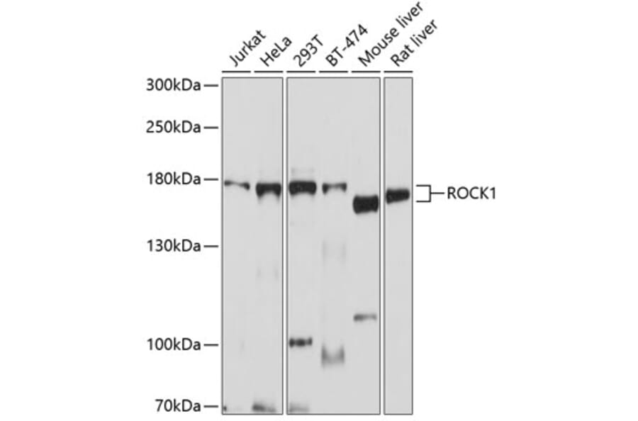 Western Blot - Anti-ROCK1 Antibody (A12527) - Antibodies.com