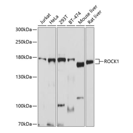 Western Blot - Anti-ROCK1 Antibody (A12527) - Antibodies.com