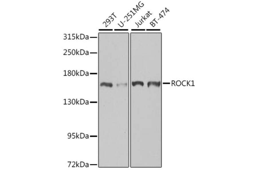 Western Blot - Anti-ROCK1 Antibody (A12527) - Antibodies.com