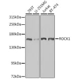Western Blot - Anti-ROCK1 Antibody (A12527) - Antibodies.com