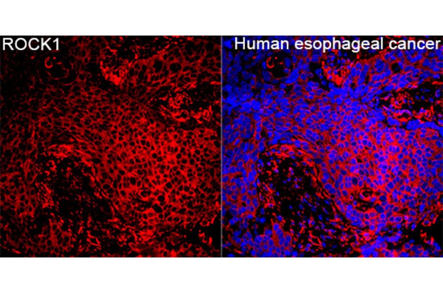 Immunofluorescence - Anti-ROCK1 Antibody (A12527) - Antibodies.com