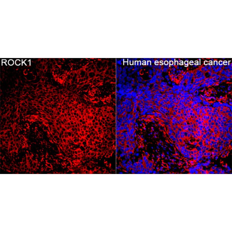 Immunofluorescence - Anti-ROCK1 Antibody (A12527) - Antibodies.com