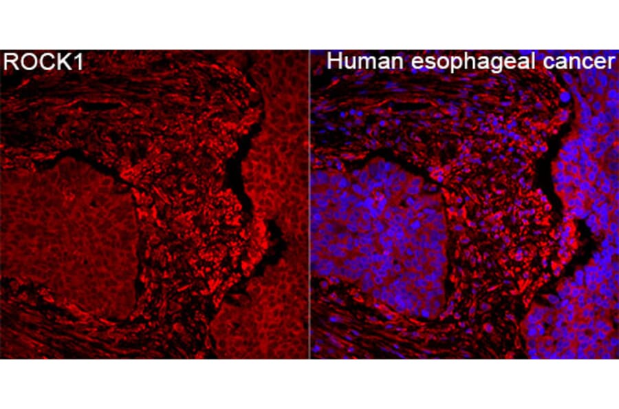 Immunofluorescence - Anti-ROCK1 Antibody (A12527) - Antibodies.com