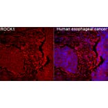 Immunofluorescence - Anti-ROCK1 Antibody (A12527) - Antibodies.com