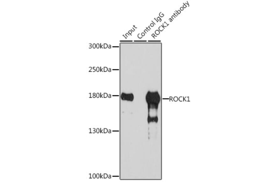 Immunoprecipitation - Anti-ROCK1 Antibody (A12527) - Antibodies.com