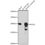 Immunoprecipitation - Anti-ROCK1 Antibody (A12527) - Antibodies.com