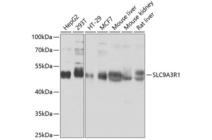 Western Blot - Anti-EBP50/NHERF-1 Antibody (A12528) - Antibodies.com