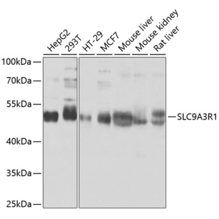 Western Blot - Anti-EBP50/NHERF-1 Antibody (A12528) - Antibodies.com