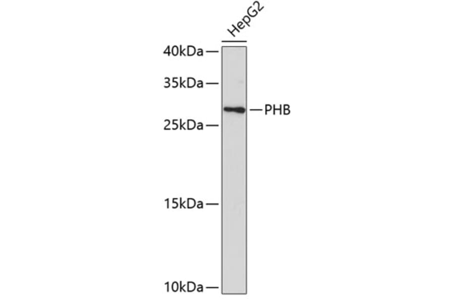 Western Blot - Anti-PHB Antibody (A0156) - Antibodies.com