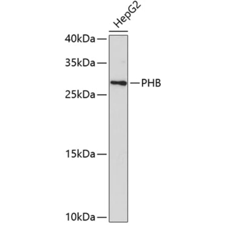 Western Blot - Anti-PHB Antibody (A0156) - Antibodies.com