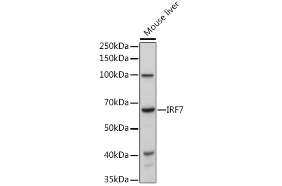 Western Blot - Anti-IRF7 Antibody (A12530) - Antibodies.com