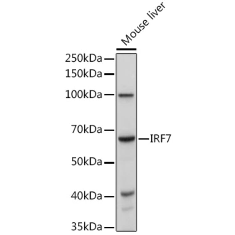 Western Blot - Anti-IRF7 Antibody (A12530) - Antibodies.com