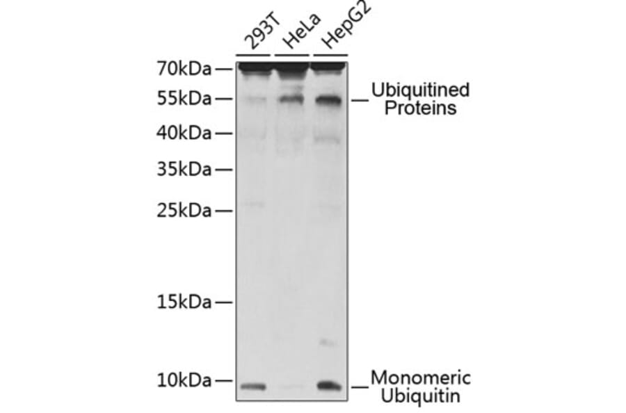 Western Blot - Anti-UBB Antibody (A0162) - Antibodies.com