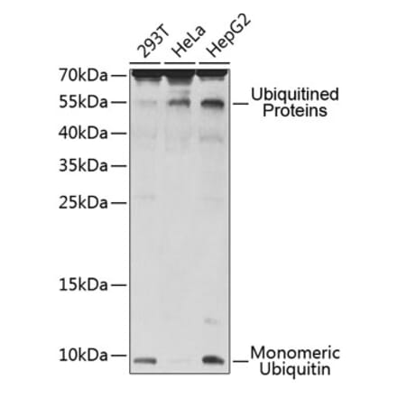Western Blot - Anti-UBB Antibody (A12531) - Antibodies.com