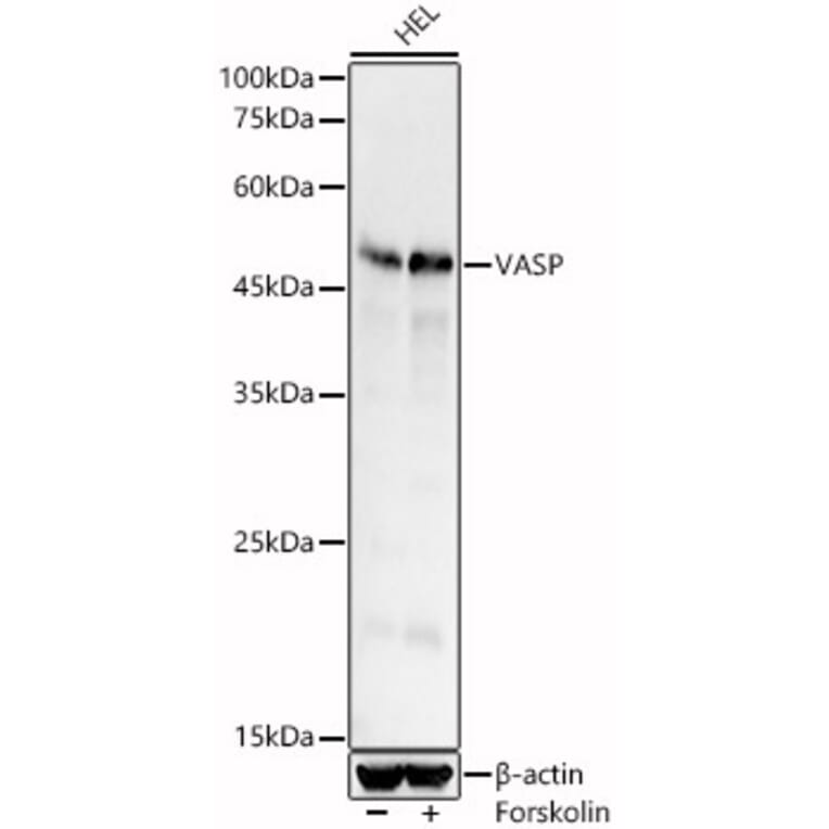 Western Blot - Anti-VASP Antibody (A12532) - Antibodies.com
