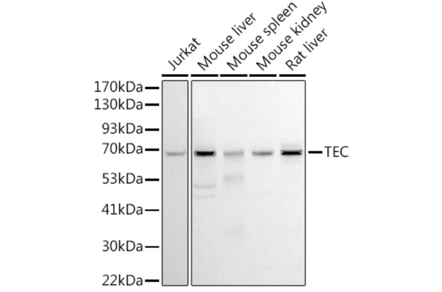 Western Blot - Anti-Tec Antibody (A12533) - Antibodies.com