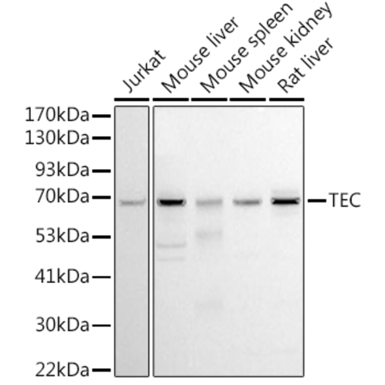 Western Blot - Anti-Tec Antibody (A12533) - Antibodies.com