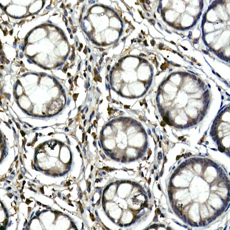 Immunohistochemistry - Anti-Tec Antibody (A12533) - Antibodies.com