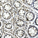 Immunohistochemistry - Anti-Tec Antibody (A12533) - Antibodies.com