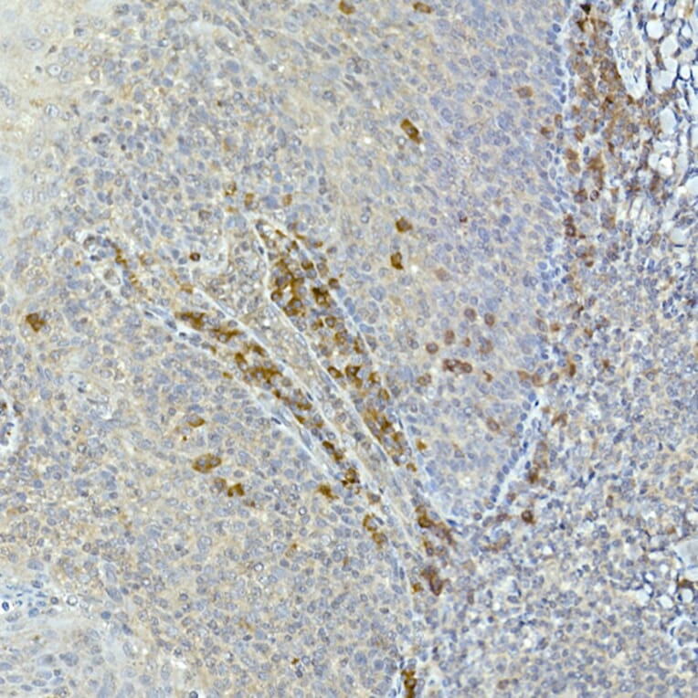Immunohistochemistry - Anti-Tec Antibody (A12533) - Antibodies.com