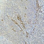 Immunohistochemistry - Anti-Tec Antibody (A12533) - Antibodies.com
