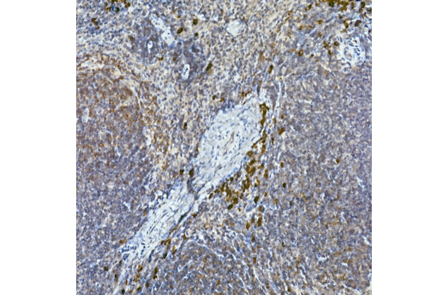 Immunohistochemistry - Anti-Tec Antibody (A12533) - Antibodies.com