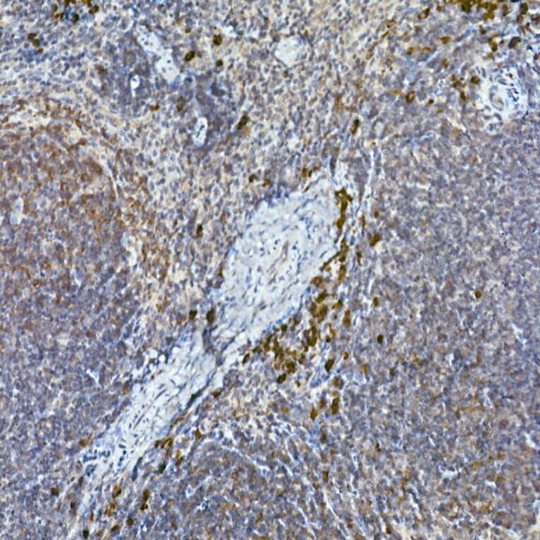 Immunohistochemistry - Anti-Tec Antibody (A12533) - Antibodies.com