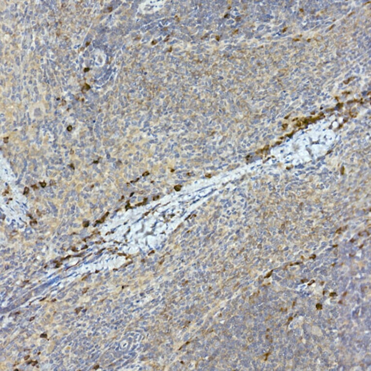 Immunohistochemistry - Anti-Tec Antibody (A12533) - Antibodies.com