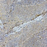Immunohistochemistry - Anti-Tec Antibody (A12533) - Antibodies.com