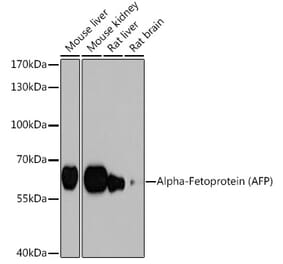 Western Blot - Anti-alpha 1 Fetoprotein Antibody (A12534) - Antibodies.com