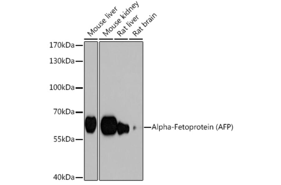 Western Blot - Anti-alpha 1 Fetoprotein Antibody (A12534) - Antibodies.com